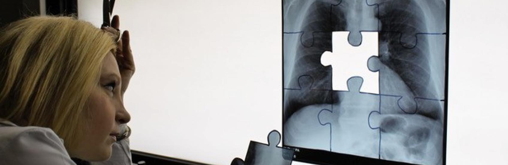 CXR Picture